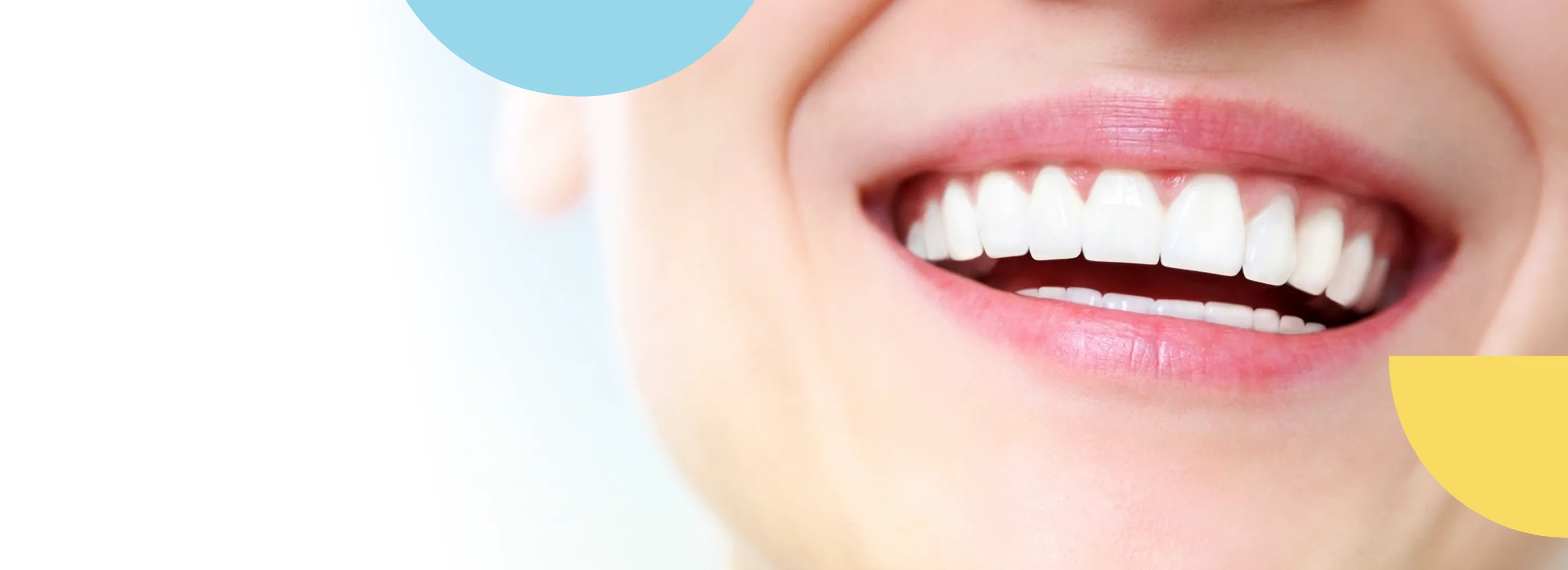 Clareamento Dental - Sorriso brilhante