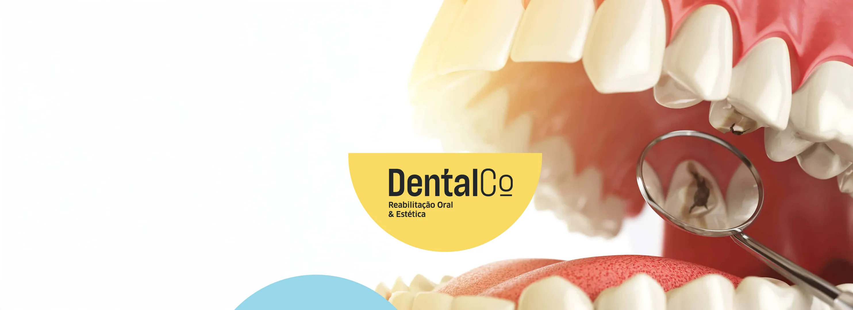 Restauração Dentária - Antes e depois